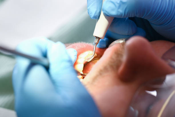 Best Emergency Dentist for Knocked-Out Tooth in Bayou Vista, TX