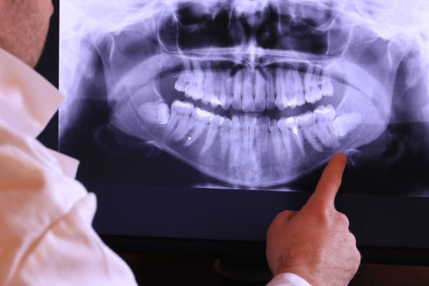 Best Weekend Emergency Dentist in Bayou Vista, TX