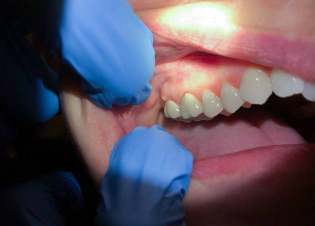 Best Broken or Cracked Tooth Emergency Dentist in Bayou Vista, TX